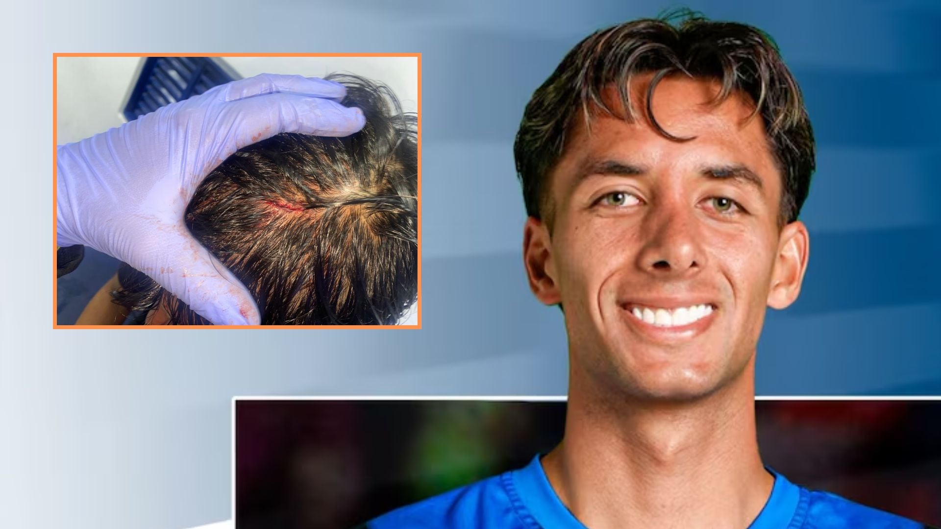 El club Boyacá Chicó identifica a Novoa como presunto agresor tras lesiones a Pimentel en partido contra Millonarios.