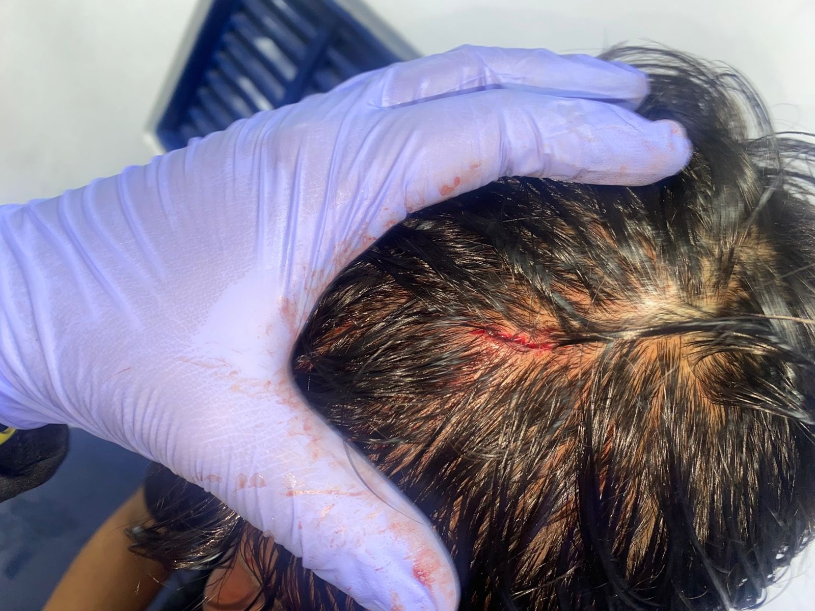 El club Boyacá Chicó identifica a Novoa como presunto agresor tras lesiones a Pimentel en partido contra Millonarios.