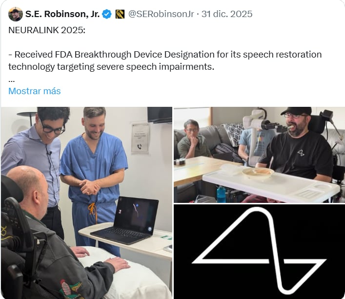 La empresa de Elon Musk busca revolucionar la neurotecnología con producción masiva de implantes.
