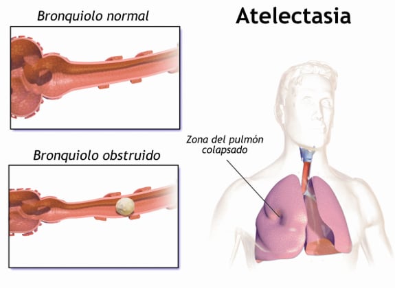 Thiago Medina sigue en terapia intensiva tras un grave accidente en moto.